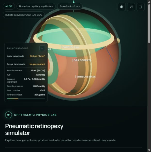 Screenshot of 3D pneumatic retinopexy eye surgery simulator